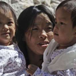 Former Conjoined Twins Return to New Life in Bhutan After Life-saving Surgery in Australia