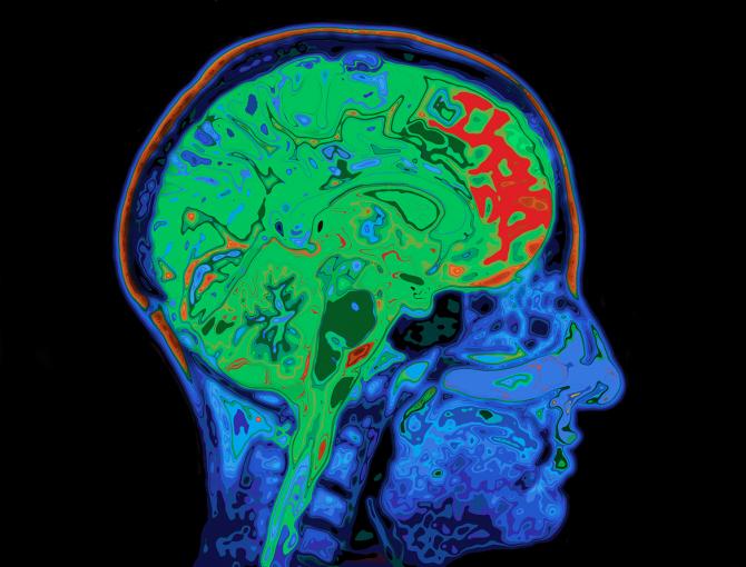 Image of an fMRI scan