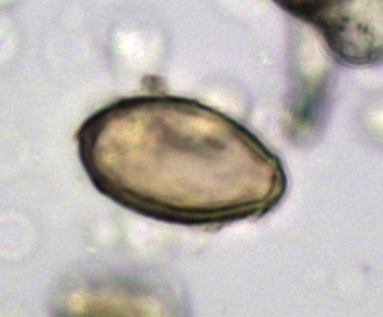 Under the microscope: a Chinese liver fluke egg discovered in the latrine at Xuanquanzhi. From sciencefocus.com