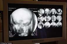 An X-ray image showing the 1,000-year-old skull of Master Cixian. From dailymail.co.uk