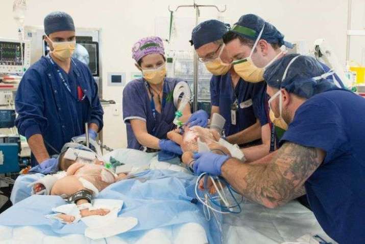 A medical team worked for more than six hours to separate the twins. From abc.net.au.